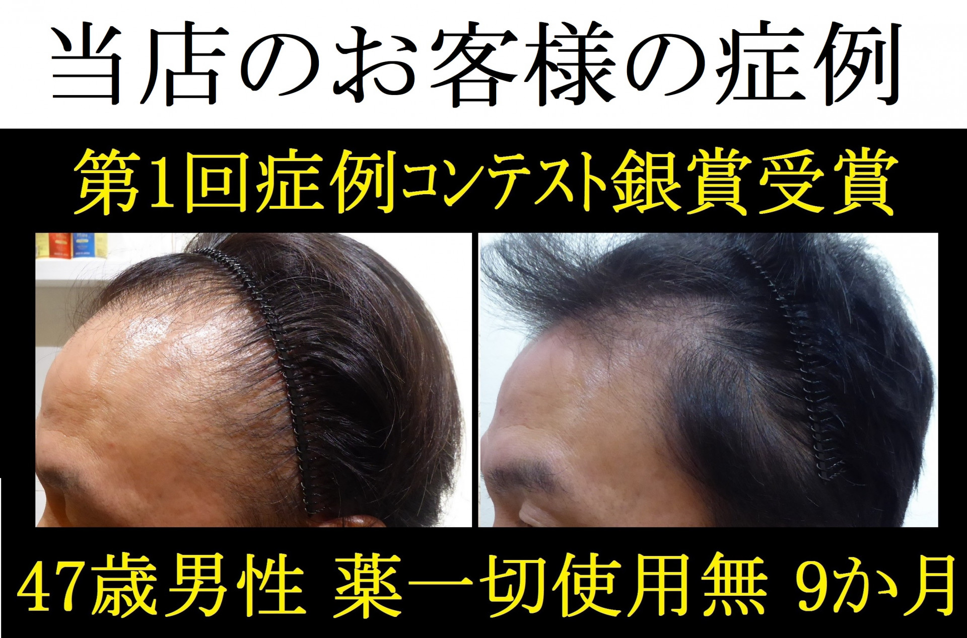 /beforeafter/