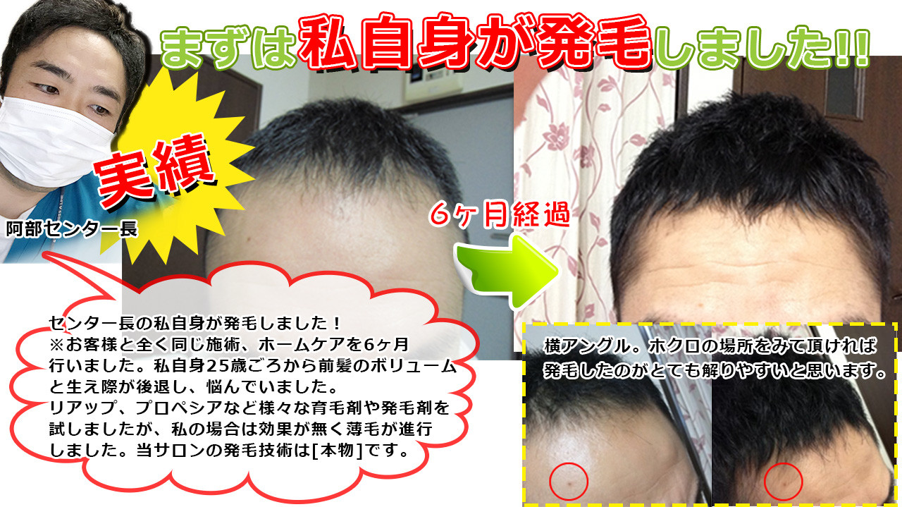 https://www.super-scalp-sendai-izumi.com/